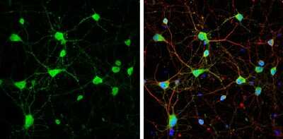 Immunocytochemistry/ Immunofluorescence: mGluR5 Antibody [NBP3-13190]