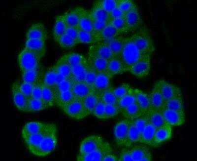 Immunocytochemistry/ Immunofluorescence: mGluR5 Antibody (ST51-00) [NBP3-11866]