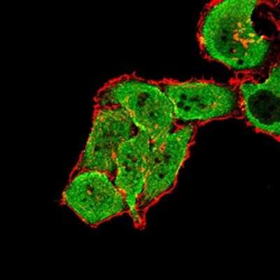 Immunocytochemistry/ Immunofluorescence: mGluR7 Antibody (7G8D3) - BSA Free [NBP2-61856]