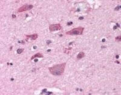 Immunohistochemistry-Paraffin: mGluR7 Antibody - BSA Free [NLS921]
