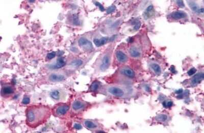 Immunohistochemistry-Paraffin: mGluR7 Antibody - BSA Free [NLS921]