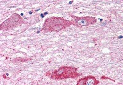 Immunohistochemistry-Paraffin: mGluR7 Antibody - BSA Free [NLS921]