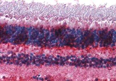 Immunohistochemistry-Paraffin: mGluR7 Antibody - BSA Free [NLS921]