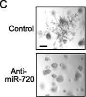 Detection of Human IgG1 by Control