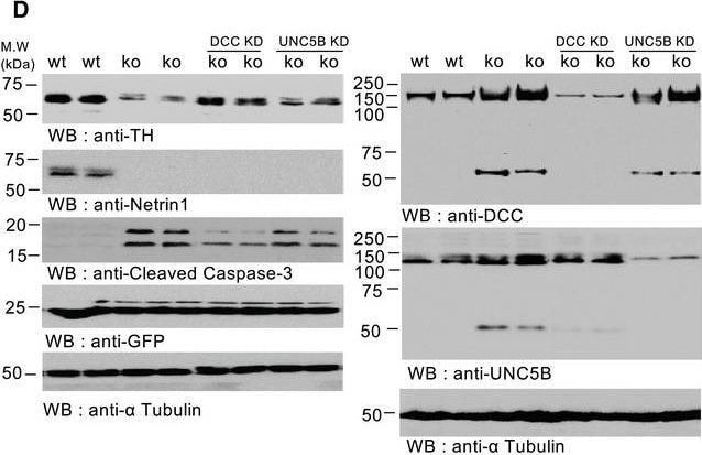 Detection of UNC5H2/UNC5B by Western Blot