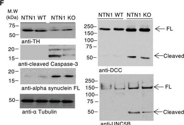 Detection of UNC5H2/UNC5B by Western Blot