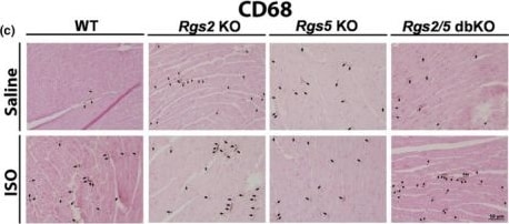 Detection of Rabbit CD68/SR-D1 by Immunohistochemistry