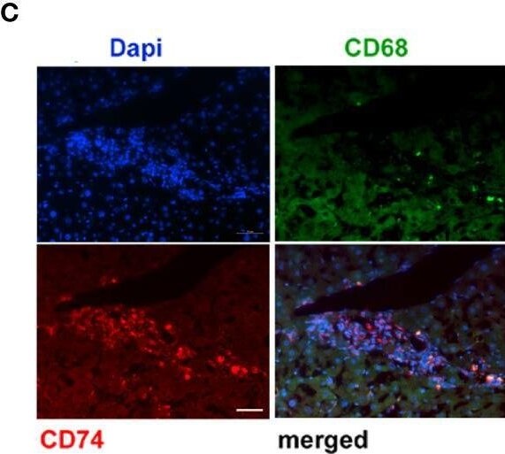 Detection of Rabbit CD68/SR-D1 by Immunohistochemistry