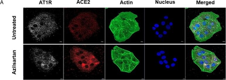Detection of AGTR-1 by Immunocytochemistry/ Immunofluorescence