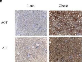 Detection of AGTR-1 by Immunohistochemistry