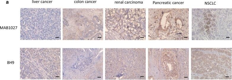 Detection of B7-H3 by Immunohistochemistry