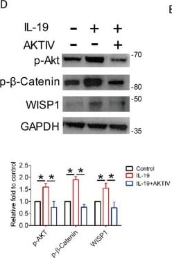 Detection of IL-19 by Western Blot