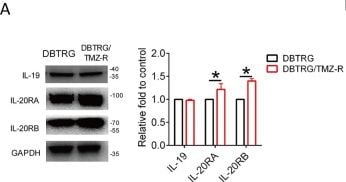 Detection of IL-19 by Western Blot
