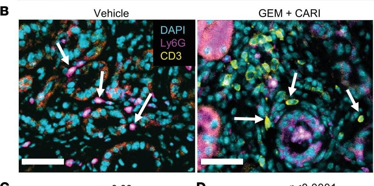 Detection of Mouse Mouse Ly-6G/Ly-6C (Gr-1) Antibody by Immunohistochemistry