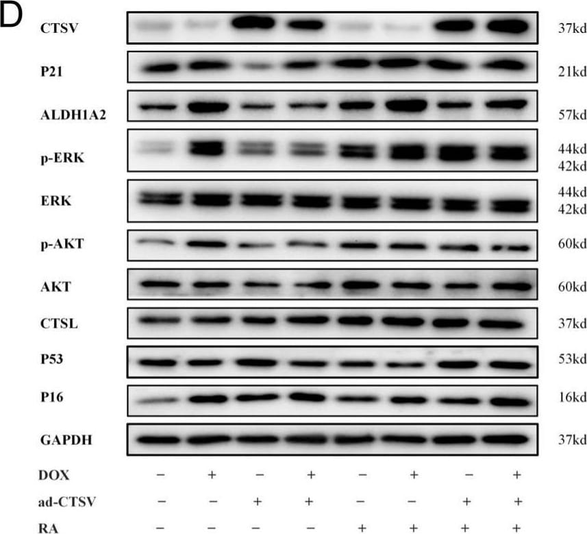 Detection of Cathepsin V by Western Blot