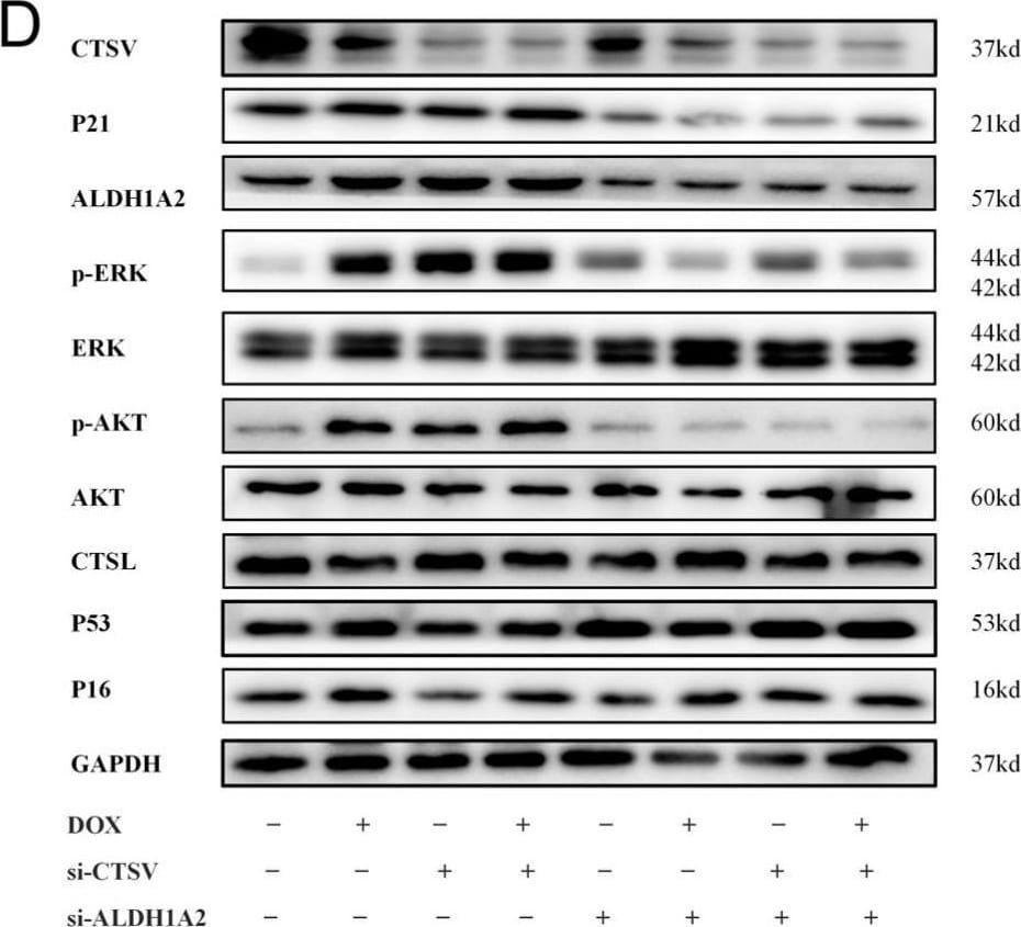 Detection of Cathepsin V by Western Blot