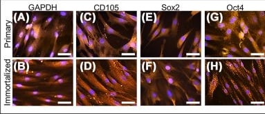Detection of Endoglin/CD105 by Immunocytochemistry/ Immunofluorescence