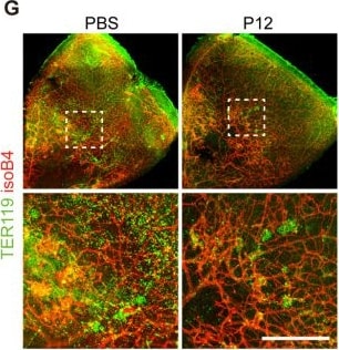 Detection of TER-119 Erythroid Antigen by Immunohistochemistry