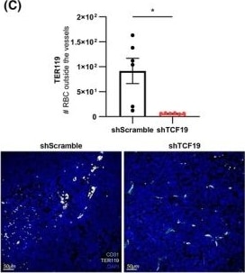 Detection of TER-119 Erythroid Antigen by Immunohistochemistry