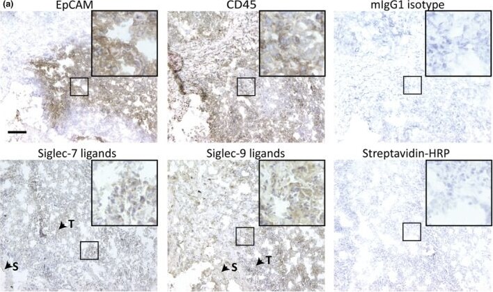 Detection of Siglec-7/CD328 by Immunohistochemistry