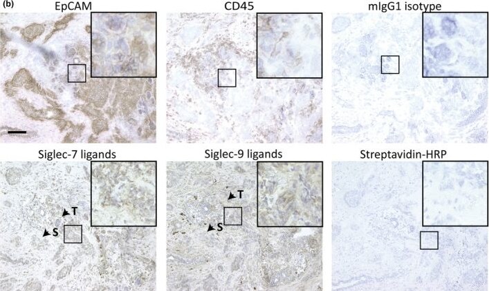 Detection of Siglec-7/CD328 by Immunohistochemistry