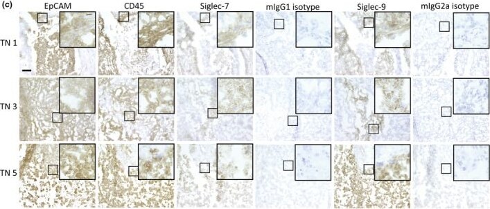 Detection of Siglec-7/CD328 by Immunohistochemistry