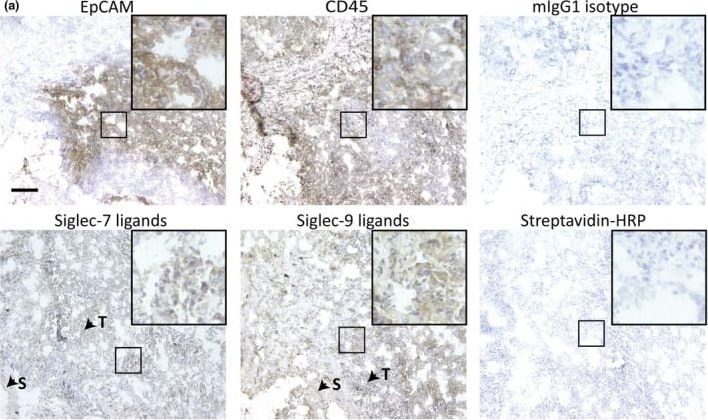 Detection of Siglec-9 by Immunohistochemistry