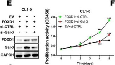 Detection of Galectin-3 by Western Blot