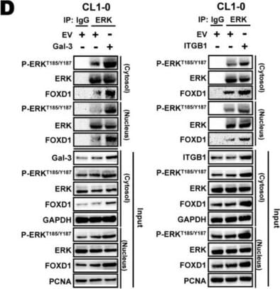Detection of Galectin-3 by Western Blot