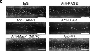 Detection of Mouse AGER by Immunocytochemistry/Immunofluorescence