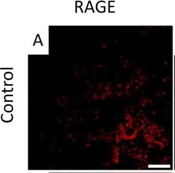 Detection of RAGE by Immunocytochemistry/ Immunofluorescence