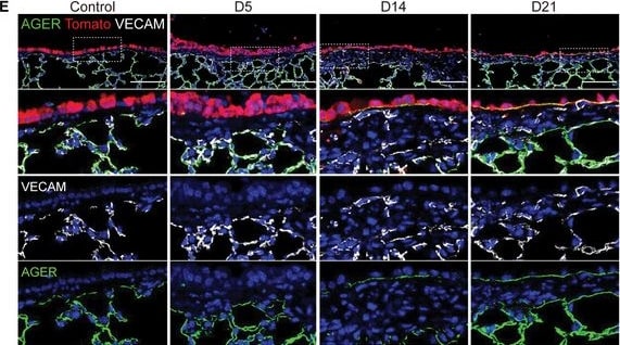 Detection of RAGE by Immunohistochemistry