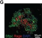 Detection of RAGE by Immunohistochemistry