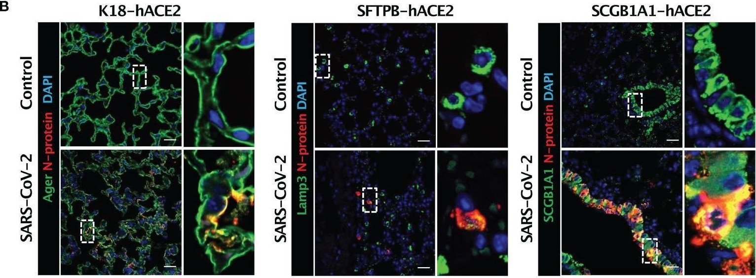 Detection of RAGE by Immunohistochemistry