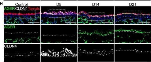 Detection of RAGE by Immunohistochemistry