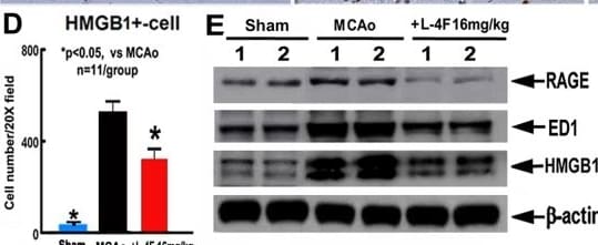 Detection of RAGE by Western Blot