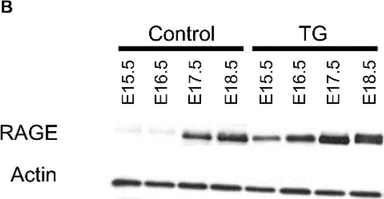 Detection of RAGE by Western Blot