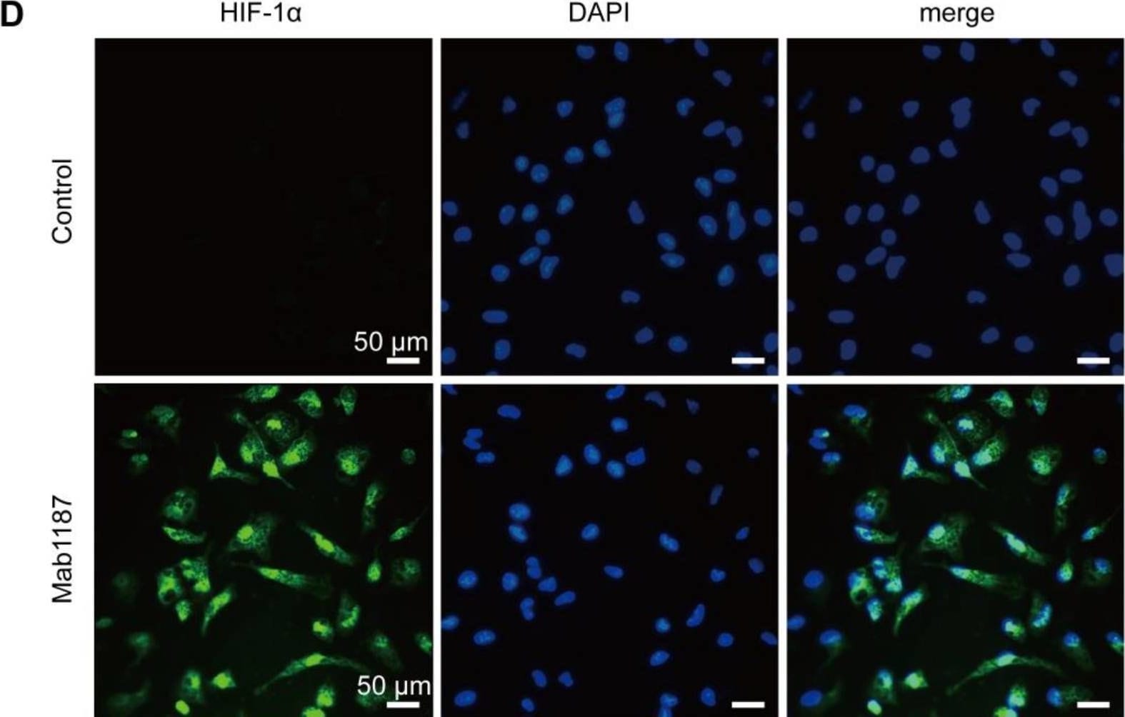 Detection of TREM-1 by Immunocytochemistry/ Immunofluorescence