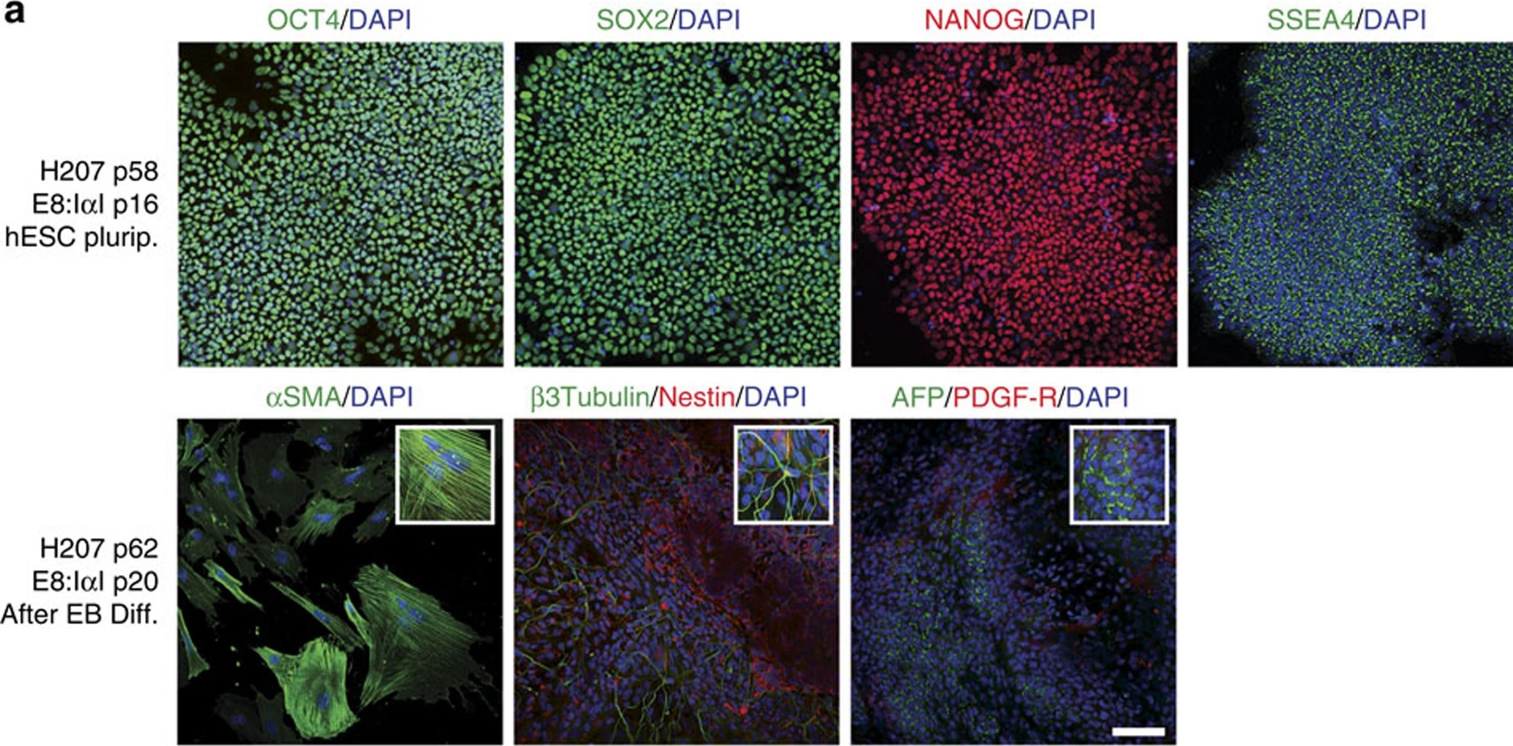Detection of Human Neuron-specific beta-III Tubulin Antibody by Immunocytochemistry/ Immunofluorescence