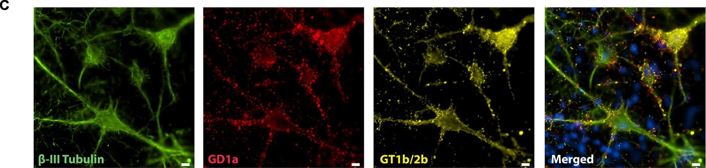 Detection of Mouse beta-III Tubulin by Immunocytochemistry/Immunofluorescence