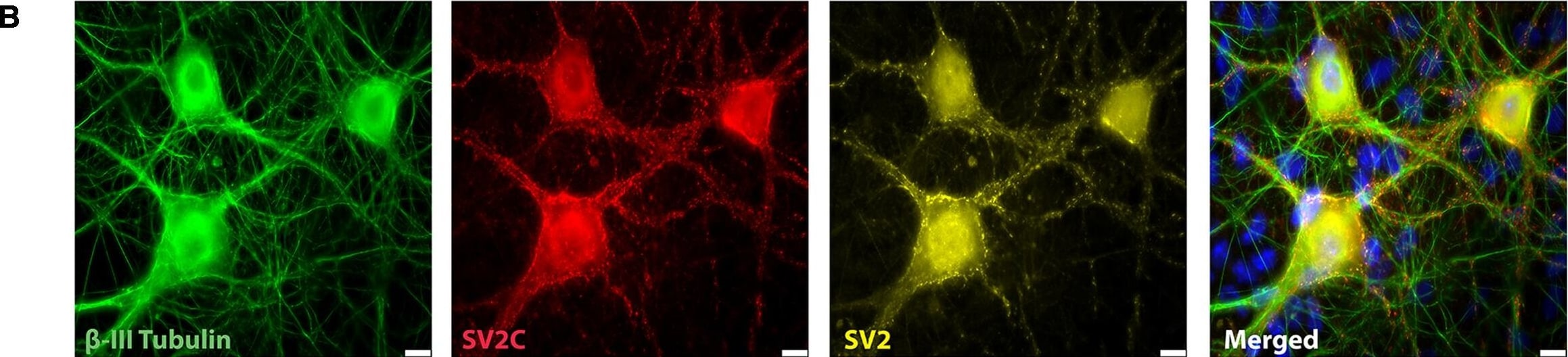 Detection of Mouse beta-III Tubulin by Immunocytochemistry/Immunofluorescence