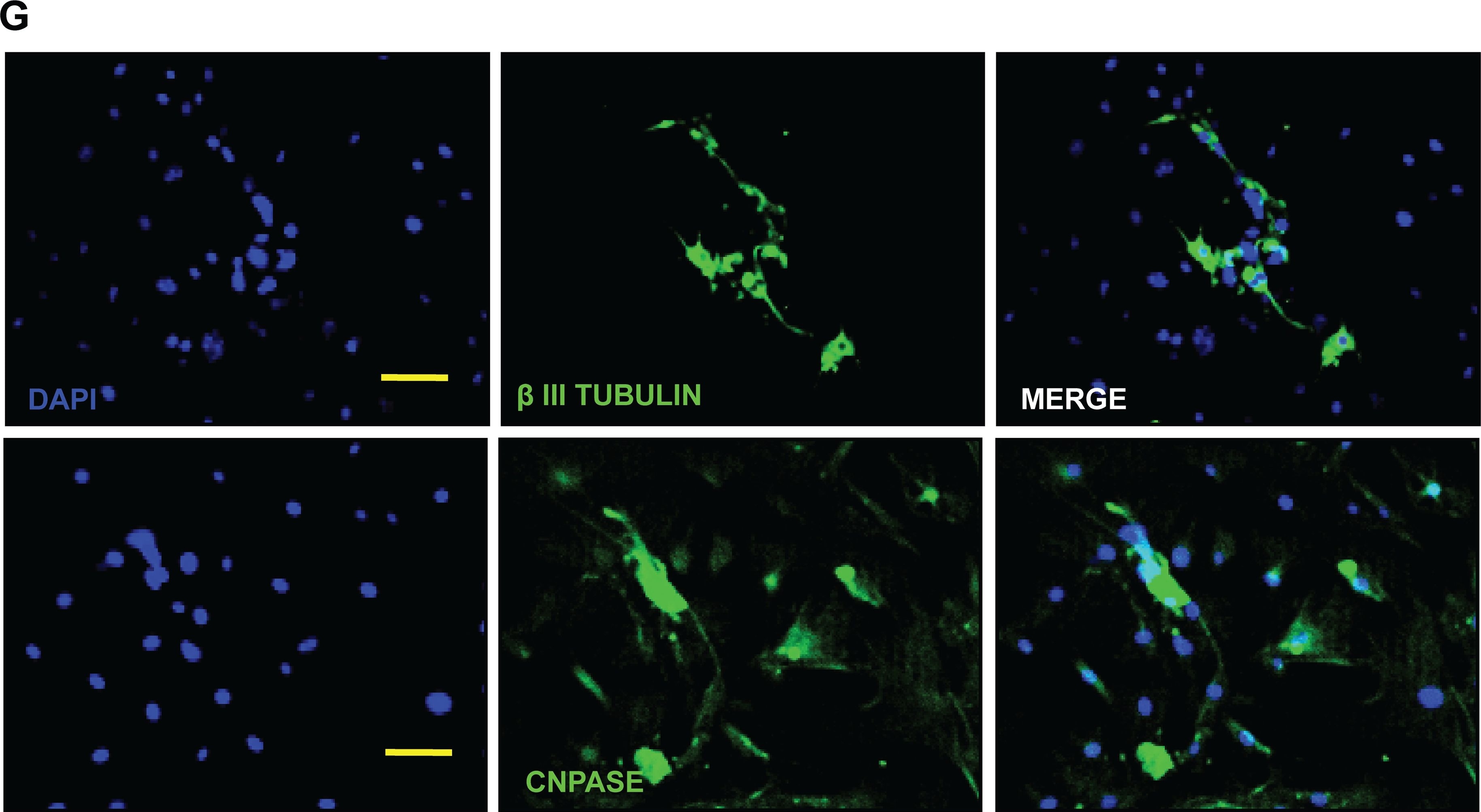 Detection of Mouse beta-III Tubulin by Immunocytochemistry/Immunofluorescence