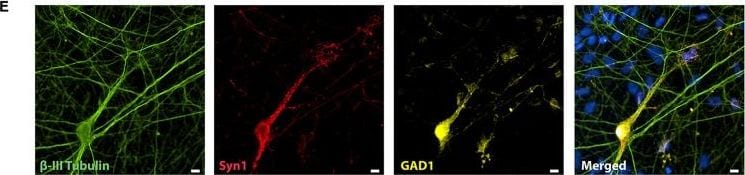 Detection of Mouse beta-III Tubulin by Immunocytochemistry/Immunofluorescence