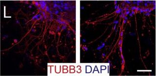 Detection of Human beta-III Tubulin by Immunocytochemistry/Immunofluorescence