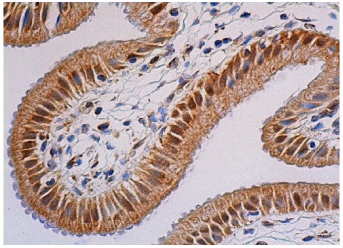 Detection of Human IL-17 RB antibody by Immunohistochemistry.