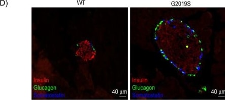 Detection of Glucagon by Immunohistochemistry