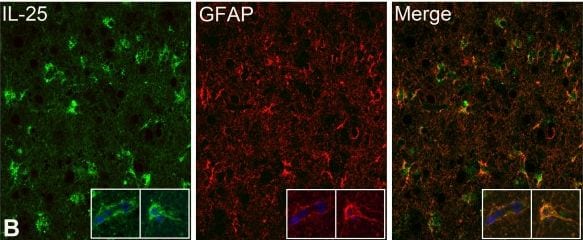 Detection of Human IL-17E/IL-25 by Immunocytochemistry/Immunofluorescence