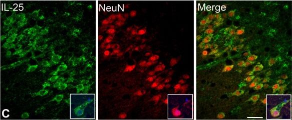 Detection of Human IL-17E/IL-25 by Immunocytochemistry/Immunofluorescence