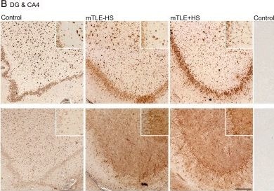 Detection of Human IL-17E/IL-25 by Immunocytochemistry/Immunofluorescence