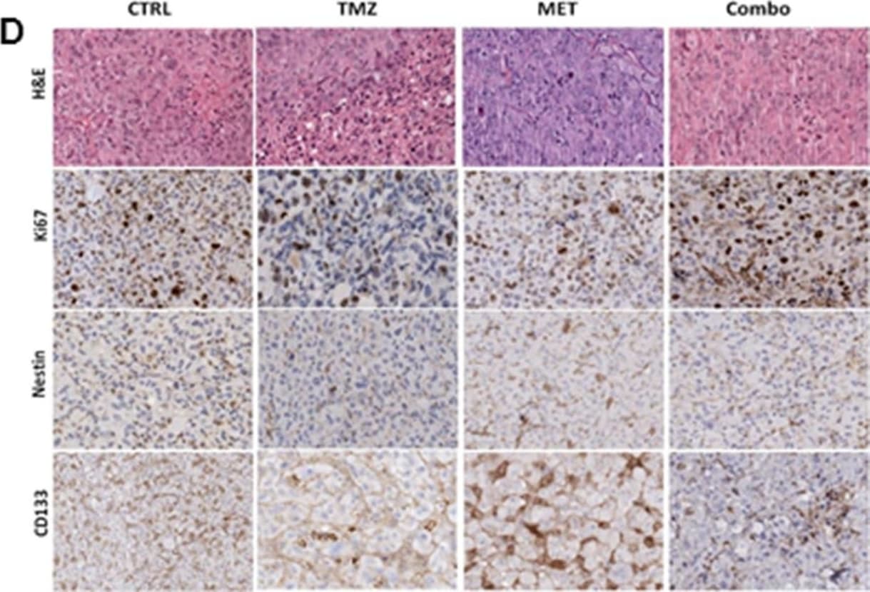 Detection of Human Nestin by Immunohistochemistry